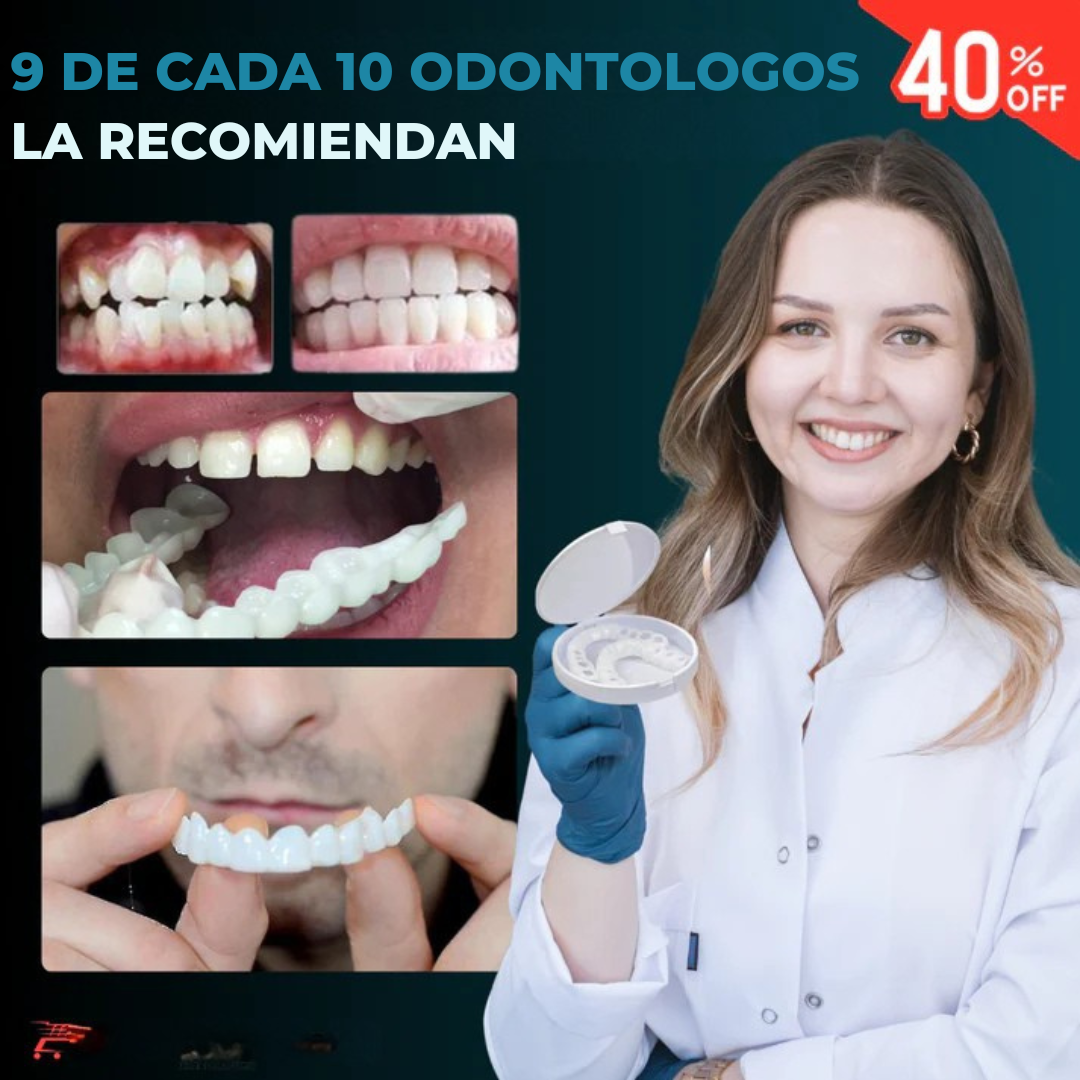 CARILLAS DENTALES - SONRISA PERFECTA EN MINUTOS
